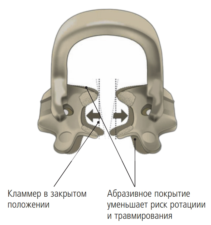Кламмер SoftClamp™ (5 шт) Kerr 5250
