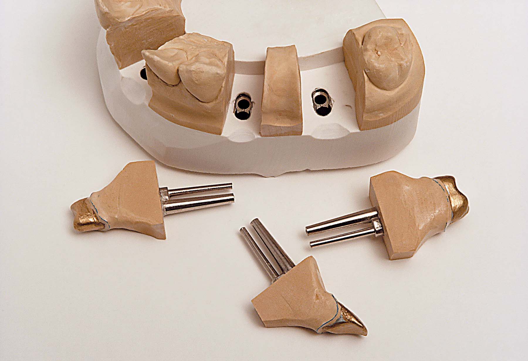 Штифты Bi-Pin длинные, с втулками и со штекерными штифтами (100 шт) Renfert 3431000