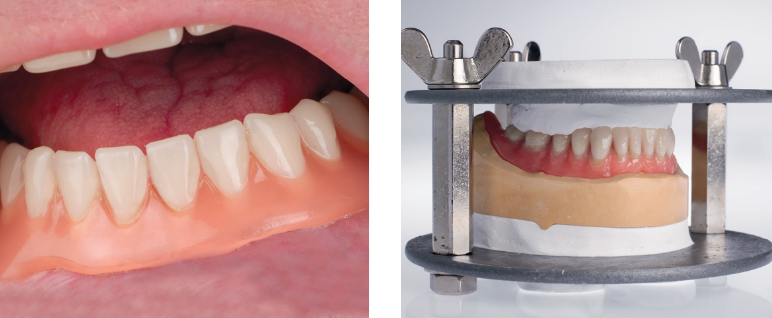 А-силикон Mucopren soft Normal pack Kettenbach 15687