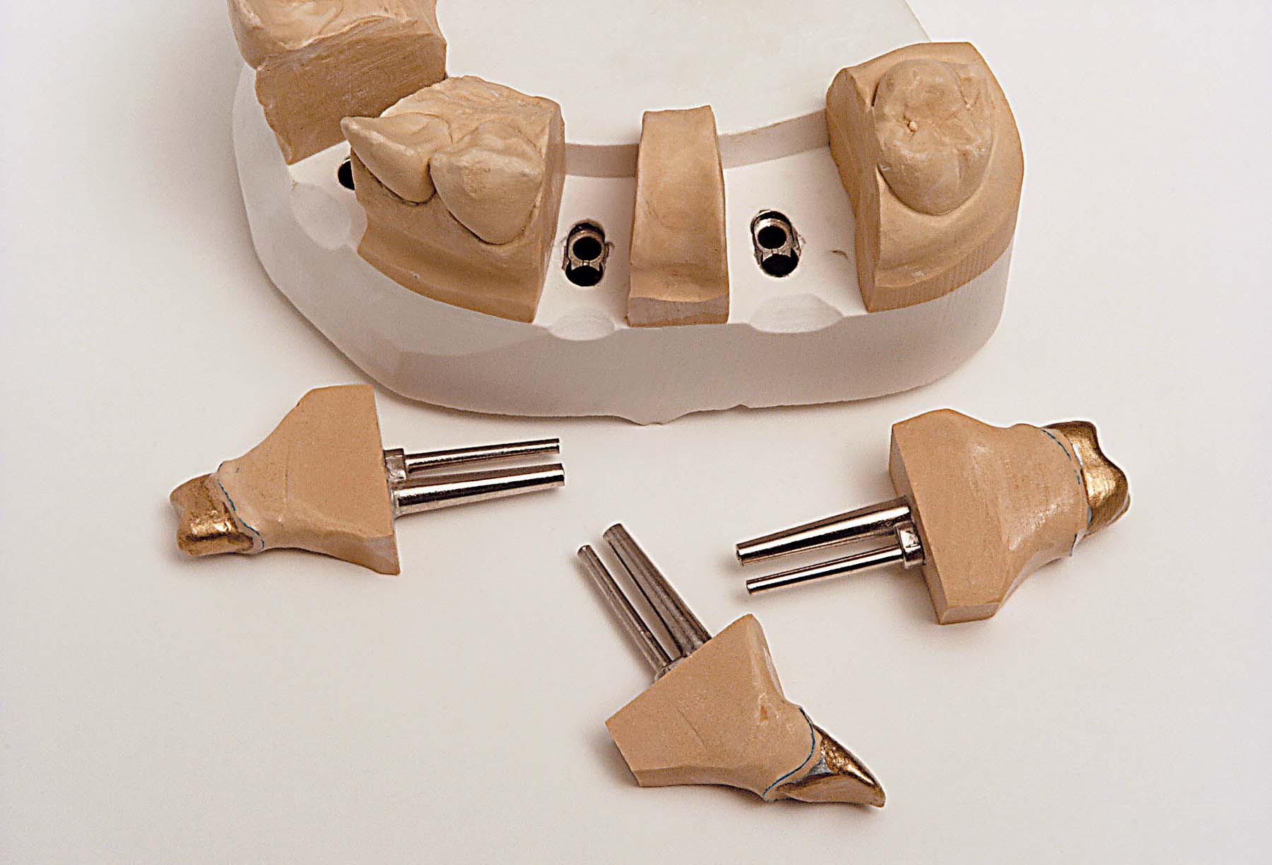 Штифты Bi-Pin короткие (1000 шт) Renfert 3362000