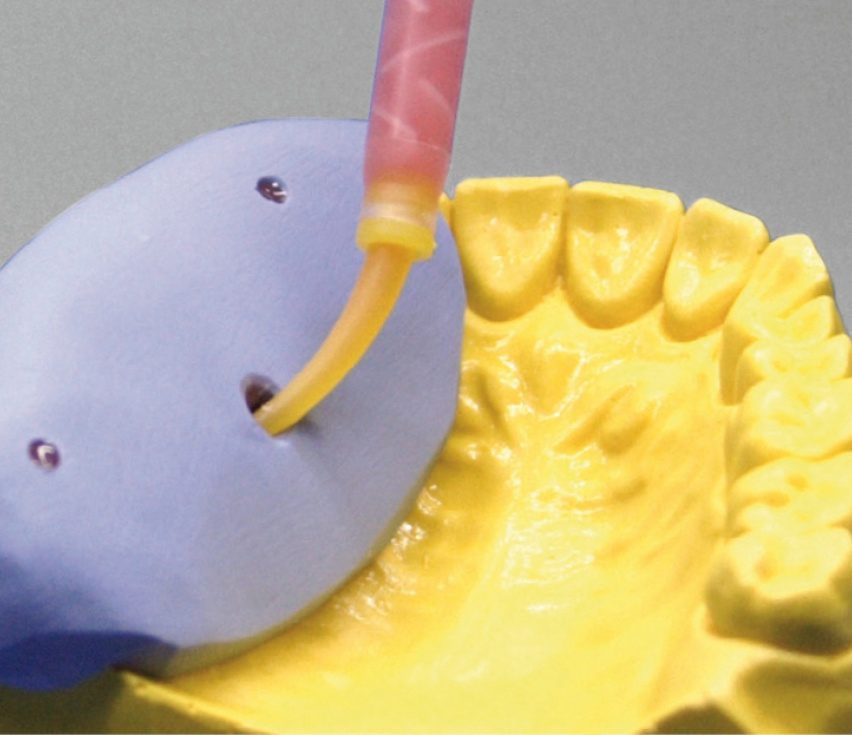 А-силикон, маска десневая, мягкая Esthetic-Mask (2х50 мл, 15 мл, смесители) Detax 02340