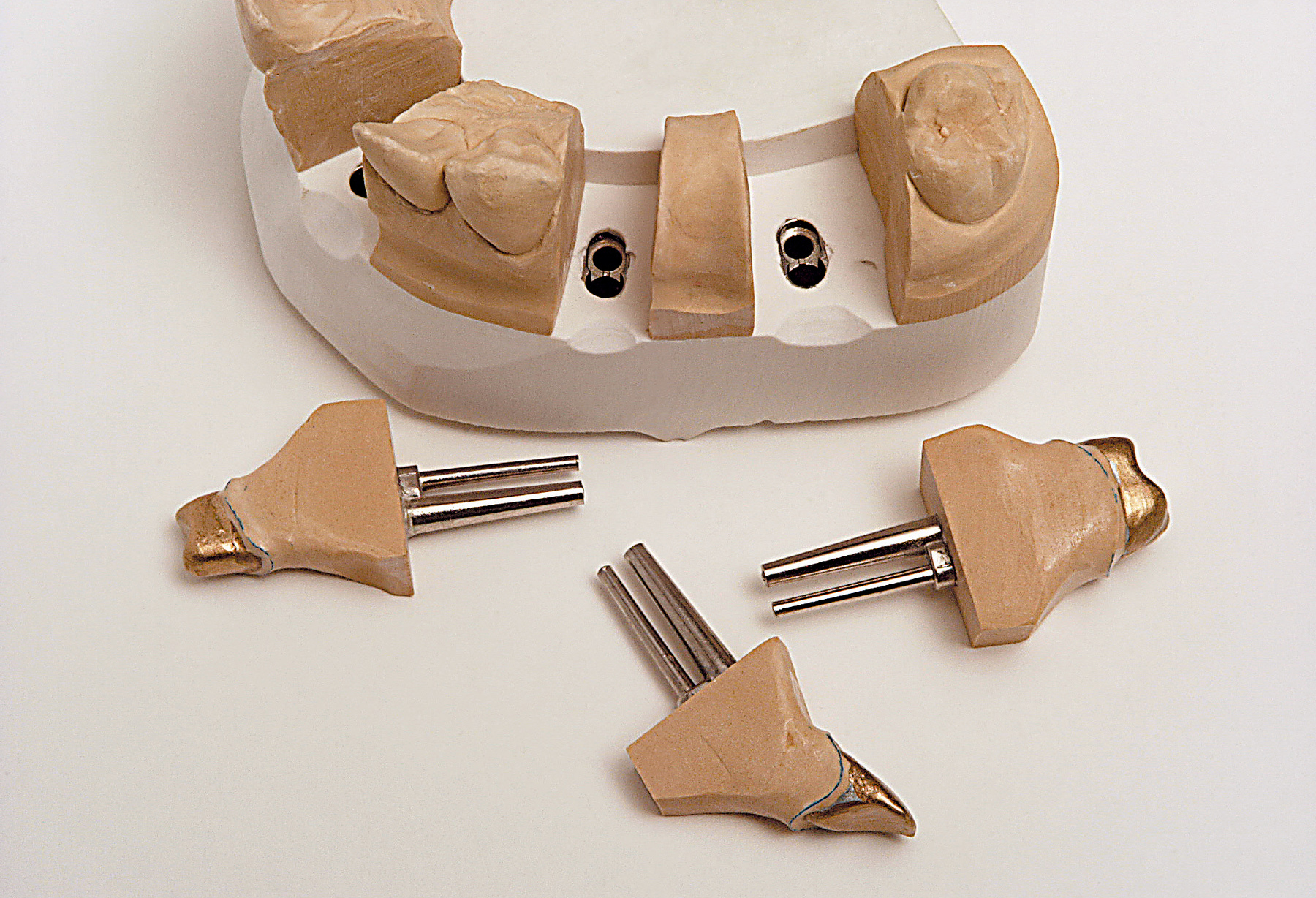 Штифты Bi-Pin короткие с втулками (1000 шт) Renfert 3262000