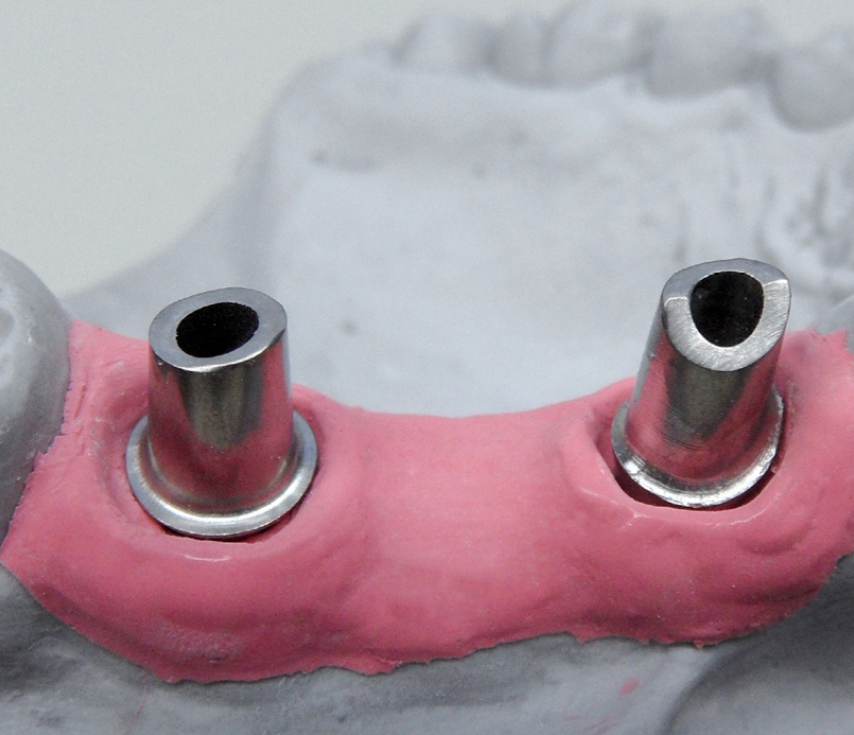 Маска десневая, твердая Implant Mask (2х10 мл, 15 мл, смесители) Detax 02529