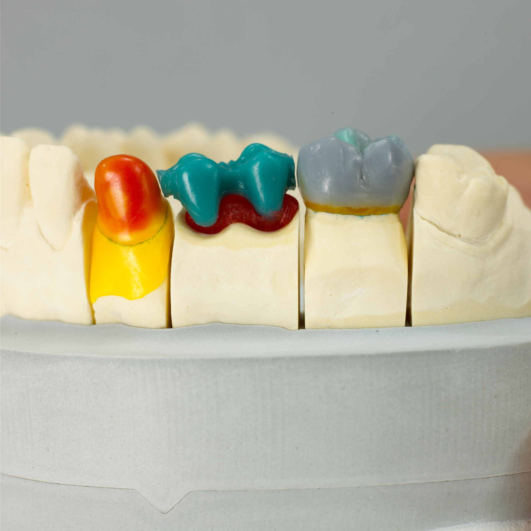 Набор звеньев восковых GEO Pontics Renfert 5000000