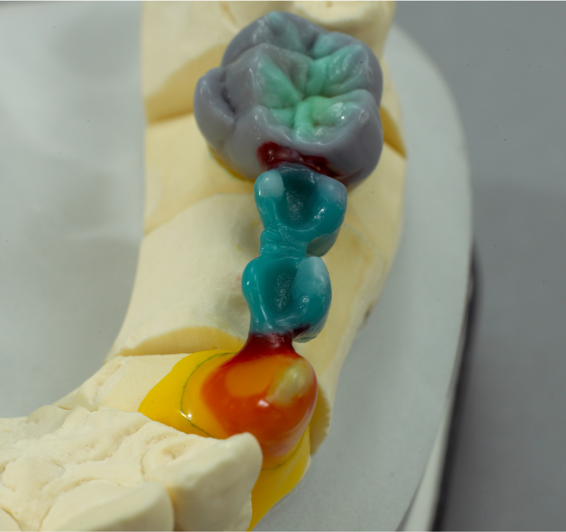 Набор звеньев восковых GEO Pontics Renfert 5000000