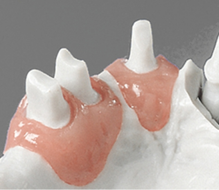 А-силикон, маска десневая, мягкая Esthetic-Mask (2х50 мл, 15 мл, смесители) Detax 02340