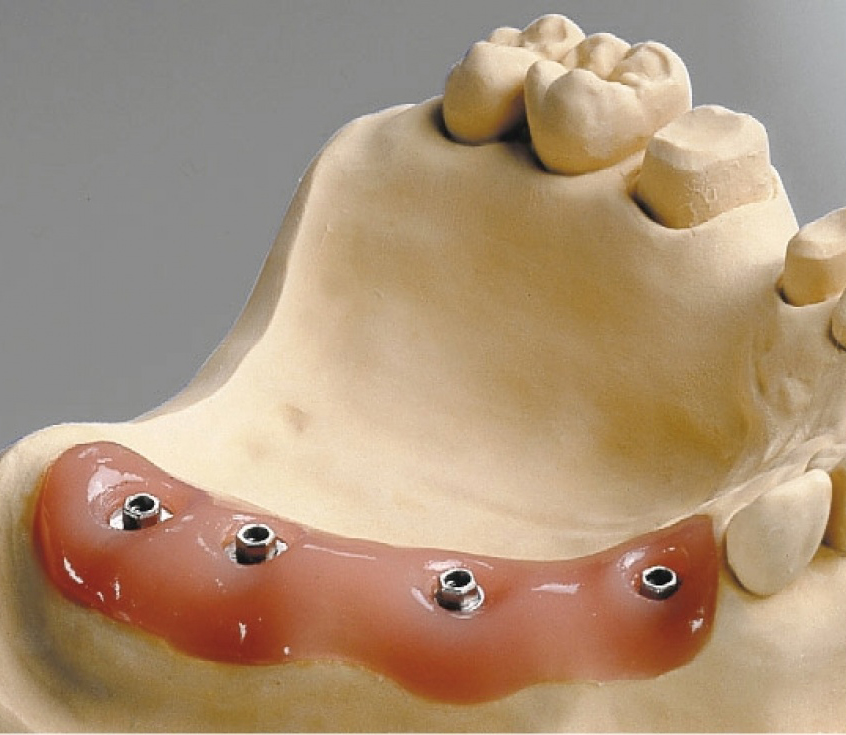 А-силикон, маска десневая, мягкая Esthetic-Mask (2х50 мл, 15 мл, смесители) Detax 02340