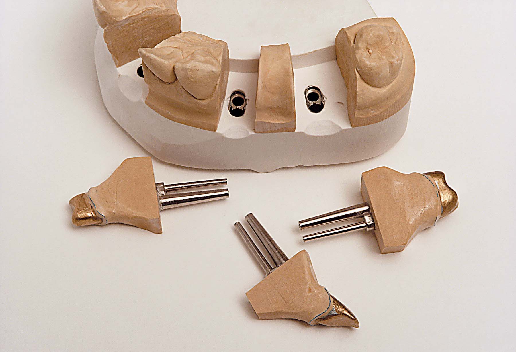 Штифты Bi-Pin длинные с втулками (100 шт) Renfert 3461000