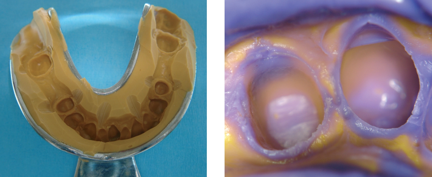 А-силикон база Panasil Putty Normal pack Kettenbach 11101