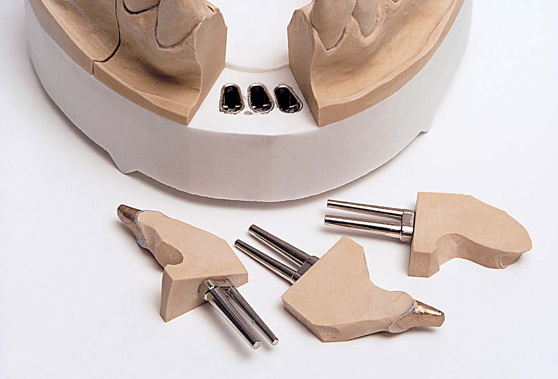 Штифты Bi-V-Pin c пластмассовыми втулками (1000 шт) Renfert 3292000