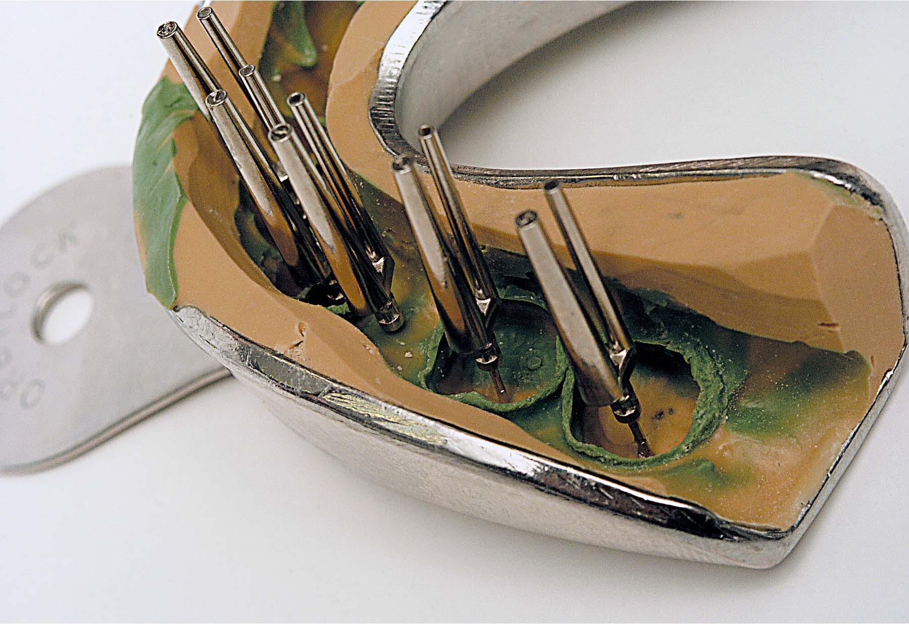 Штифты Bi-Pin длинные с втулками (100 шт) Renfert 3461000