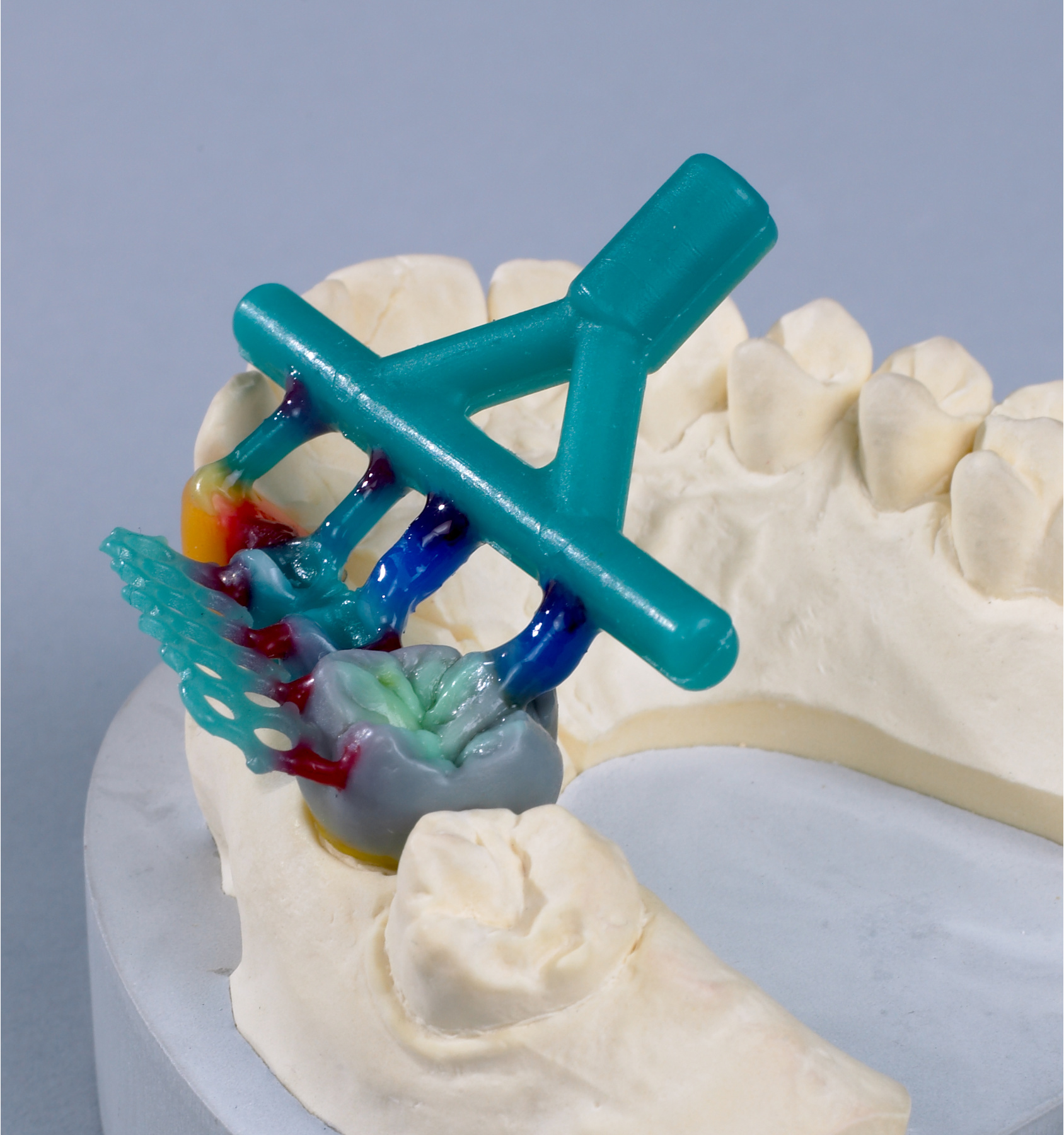 Балки  восковые литейные GEO (100 шт) 6803000